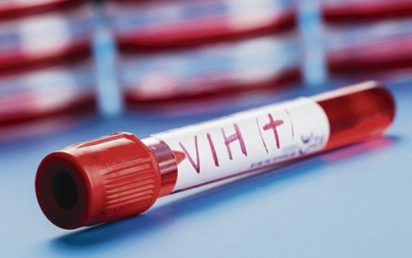 Tocumen con la mayor concentración de casos de VIH y Sida en la región Metropolitana
