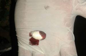 La droga estaba cubierta con cáscara de frijoles.