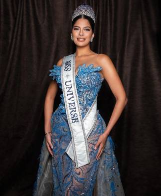 Ansiedad, el síndrome de las bellezas