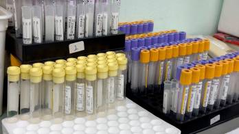 Según la CSS, actualmente se están recibiendo solo alrededor de 25 donaciones e incluso menos.