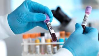 Abogan por tomar medidas.