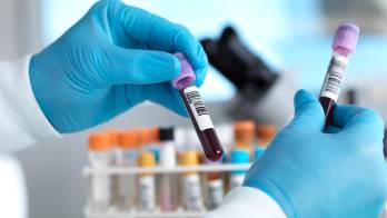 El Minsa recomienda acudir a los centros de salud, de presentar fiebre y dolor de cabeza.