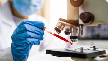 Minsa redobla la vigilancia epidemiológica.