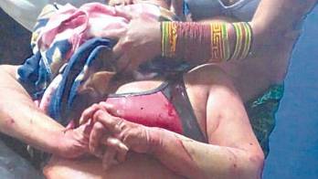 Docente atacada en Guna Yala. Le desfiguran el rostro