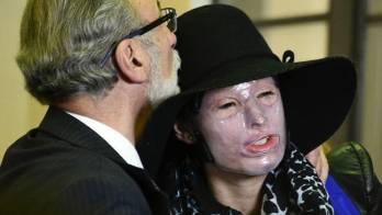 Culpan al hombre que arrojó ácido