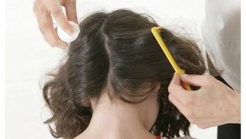 Vegana no mata los piojos de su hija porque son seres vivos