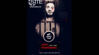 En la imagén se ve a Messi con una gota de sangre en sus ojos.