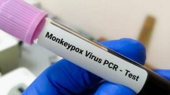 Casos de viruela aumentan a 225 infectados