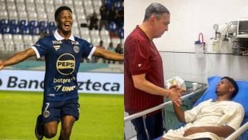 Tras sufrir una luxofractura de peroné durante el partido de anoche, Jorge ‘Puchulín’ fue operado a primeras horas de este sábado, según confirmó el F. C. Motagua.