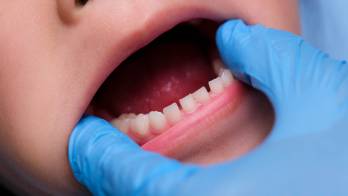 Ocurrió en la India, en 2019, fue un récord en la medicina mundial.