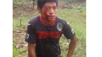 Varios heridos deja el desalojo en Barro Blanco, denuncian en la comarca