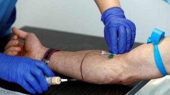 Un nuevo análisis de sangre detecta alzhéimer antes de los primeros síntomas