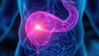 El cáncer de estómago (gástrico) causa unas 641,000 muertes al año en todo el mundo.