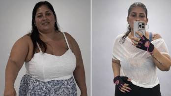 Roxana Jaén se sometió en octubre del 2025 a una cirugía baríatrica en Colombia.