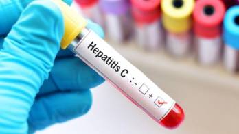 ‘Hepatiza’ con tu hígado y evita la hepatitis