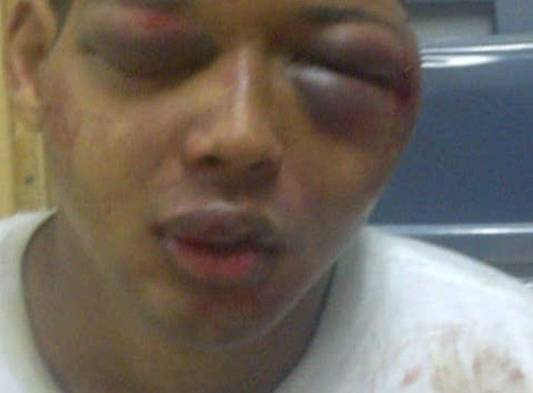 Así quedó el rostro de Martínez por los golpes