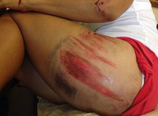 Aquí, una de las marcas que le dejó aquel camión.