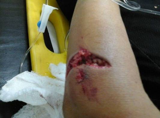 Las heridas fueron profundas, dolorosas e injustas.