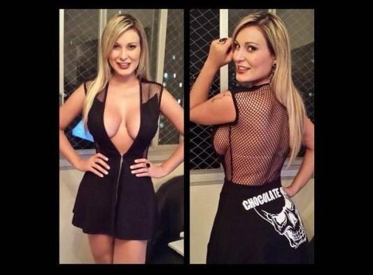 Reina de la belleza brasileña en estado grave por tratamiento de estética..