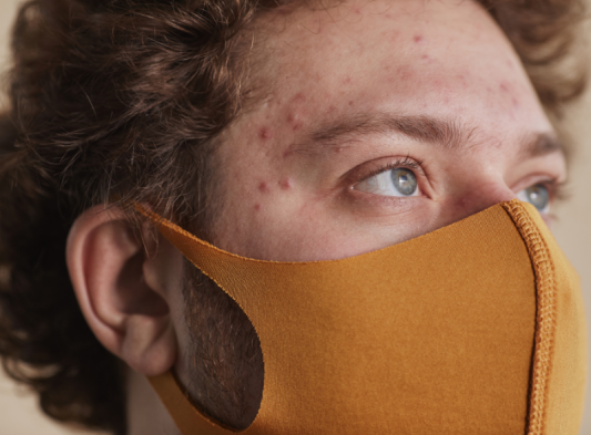 ¿Tienes problemas de acné por usar cubrebocas?