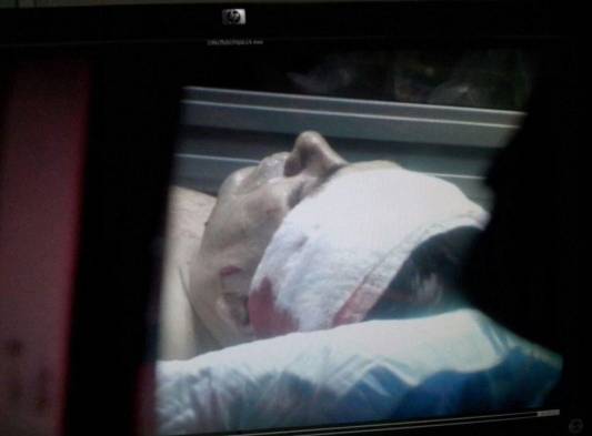 Se mantiene en Sala de Cuidados Intensivos.