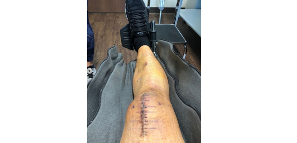 Jerry Rivera fue sometido a una operación en la rodilla tras caerse del escenario