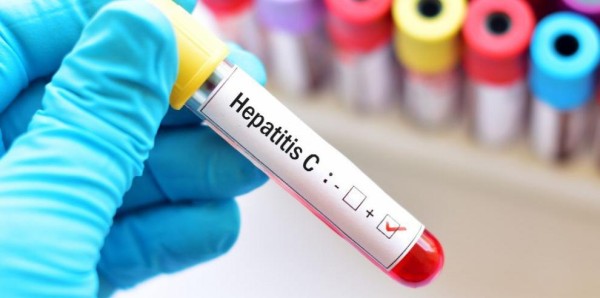 ‘Hepatiza’ con tu hígado y evita la hepatitis