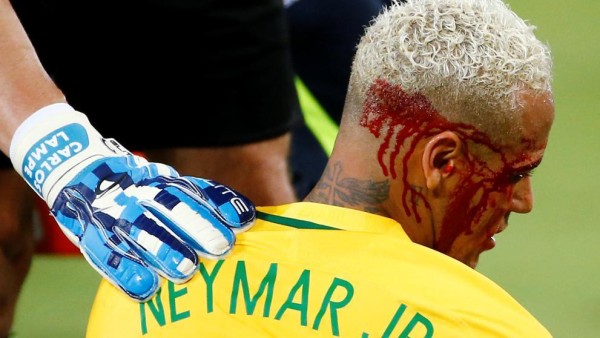 Neymar fue sustituido a los 67 minutos, tras sufrir un codazo de Duk que le dejó con sangre a la altura de la ceja.