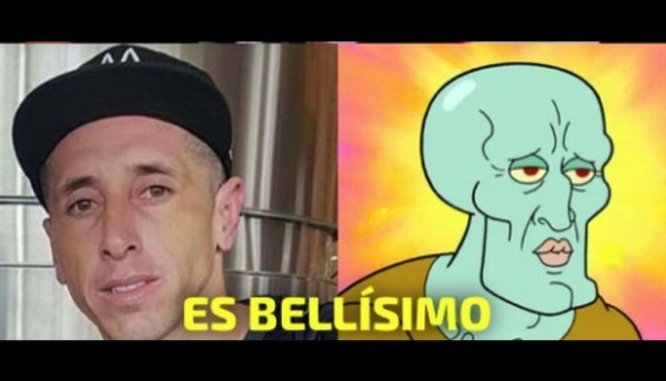 Futbolista mexicano se somete a cirugía plástica en el rostro y genera memes