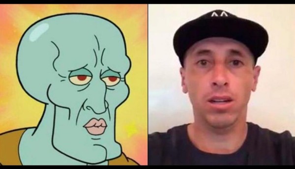 Futbolista mexicano se somete a cirugía plástica en el rostro y genera memes