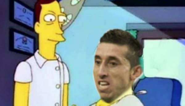 Futbolista mexicano se somete a cirugía plástica en el rostro y genera memes