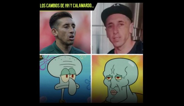 Futbolista mexicano se somete a cirugía plástica en el rostro y genera memes