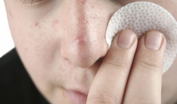 Elimina los puntos negros de la nariz