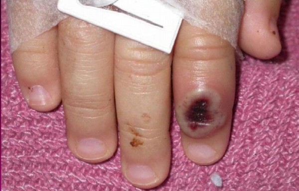 Panamá mantiene una alerta sanitaria.