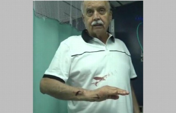 El suceso se registró la tarde de este sábado, en la ciudad capital.