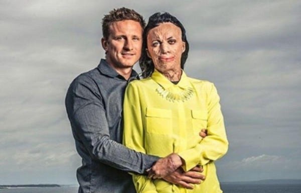 Una historia de amor que estremeció a Australia