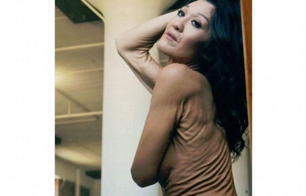 Le saca provecho a su enfermedad