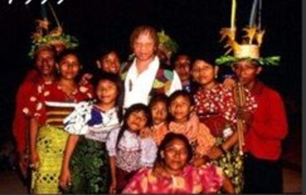 El Día del Albinismo es el 13 de junio.