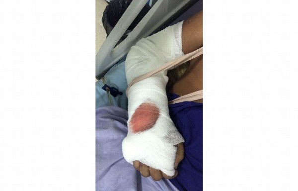 Rodríguez sufrió herida en brazo