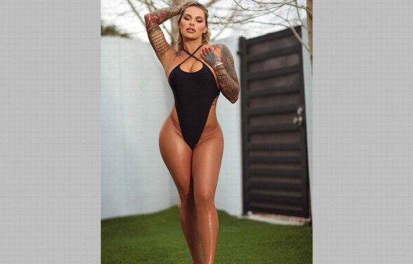 Cirugía le cambió la vida a Virginia. Parte 1