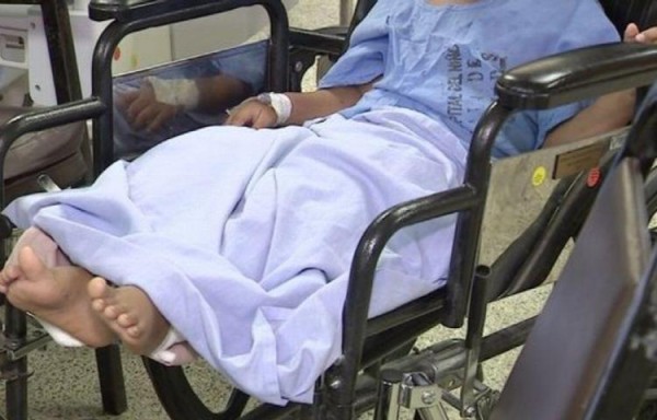 Minsa reitera campaña “No más niños quemados”