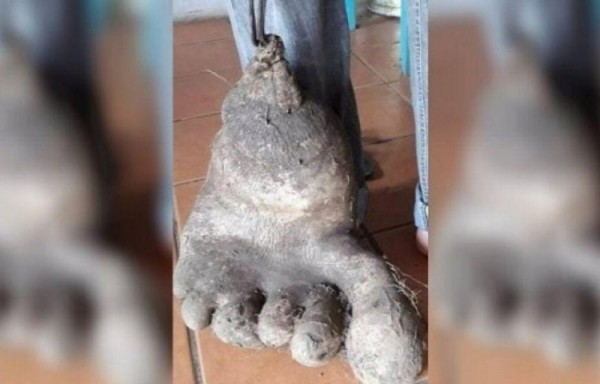 Papa mutante en forma de pie humano