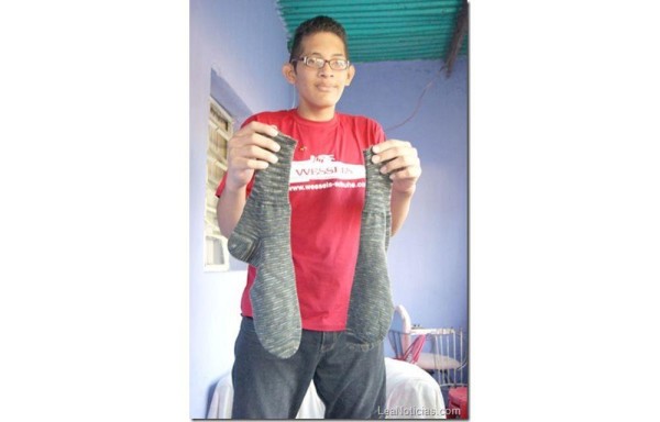 El pie más grande está en Venezuela