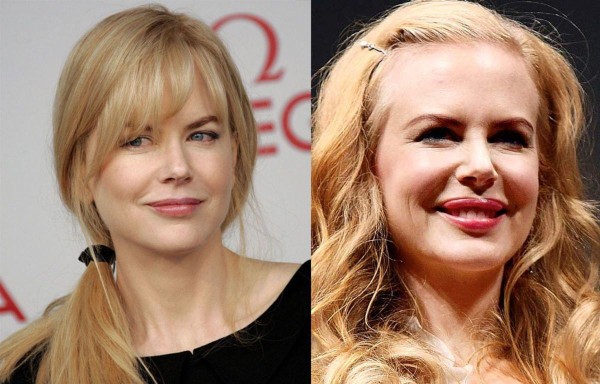 Nicole Kidman.