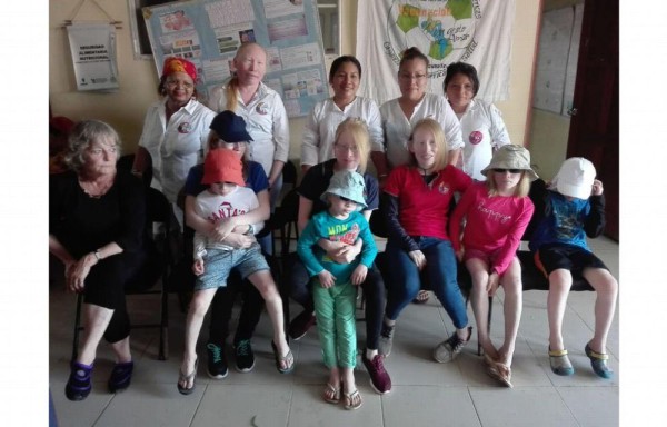 Parte de los integrantes de la junta directiva de la Asociación SOS Albinos de Panamá.