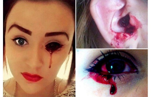 Llora sangre y no se sabe porqué