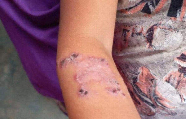 31 afectados en la Región Metropolitana.