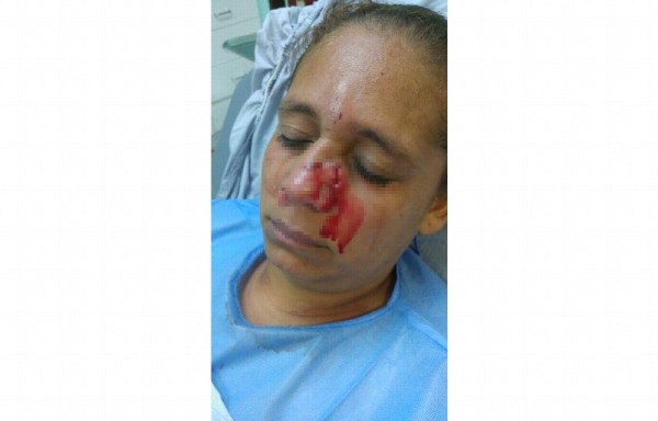 El desquisiado hombre agredió a la mujer con una piedra y le partió el tabique por lo que tuvo que ser hospitalizada.