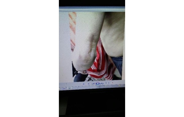 Por segunda vez, Ventura Ceballos se evade de La Nueva Joya