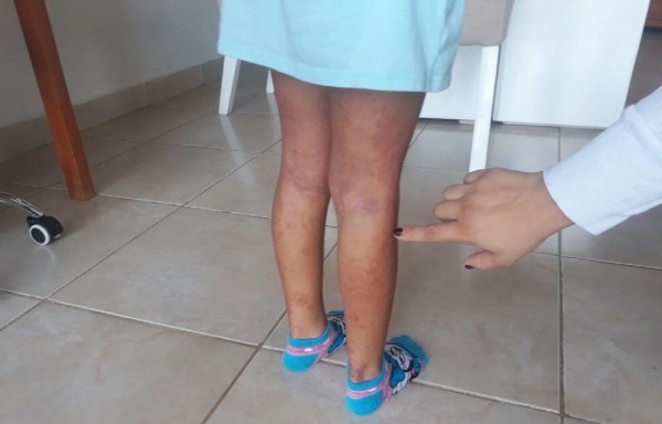 Aseguran que hay más afectados.